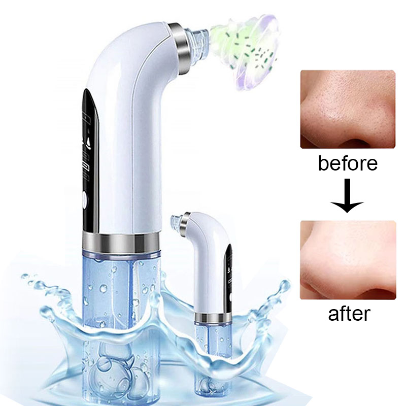 Water Dermabrasion Hydra Peeli - Air Bubble Remover recensie en prijs